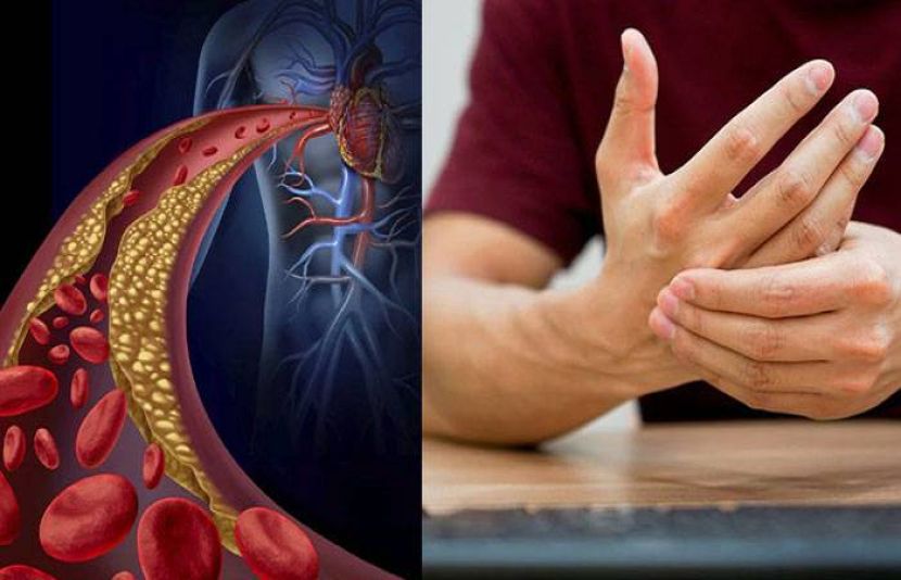 ماہرین صحت کے مطابق ہائی کولیسٹرول آج کے دور کا ایک عام مگر خطرناک مسئلہ بنتا جا رہا ہے