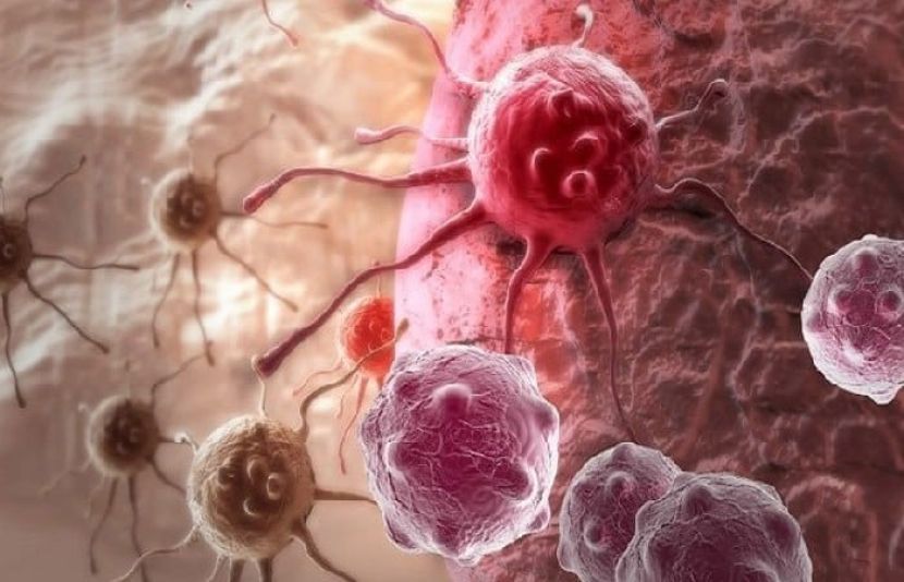ماہرین کے مطابق کینسر کی گرفت میں جینیات کلیدی حیثیت رکھتی ہیں