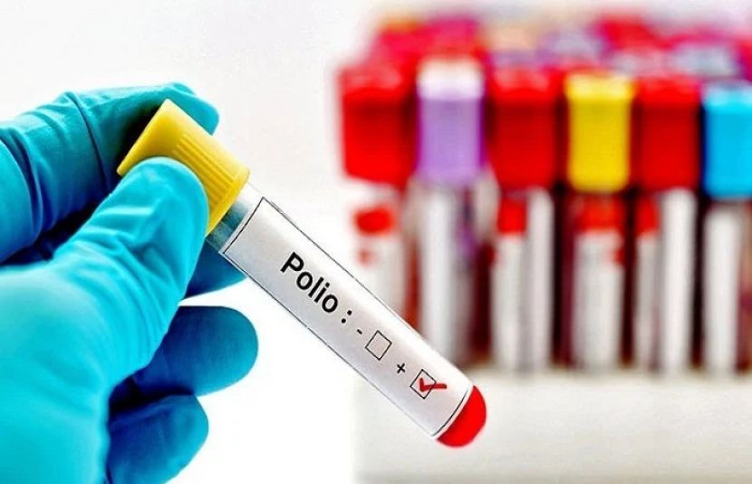 جرمن شہر ہیمبرگ میں وائلڈ پولیو وائرس کا سراغ لگایا گیا