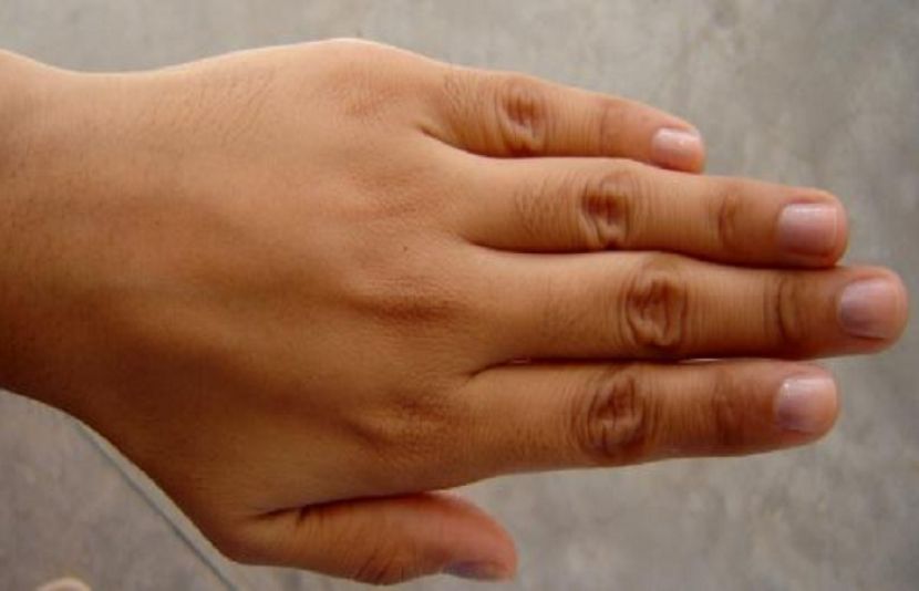 خواتین کے ہاتھ مردوں کے مقابلے میں زیادہ ٹھنڈے ہوتے ہیں