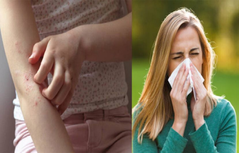موسم سرما میں بعض افراد کو الرجی کیوں ہوتی ہے؟