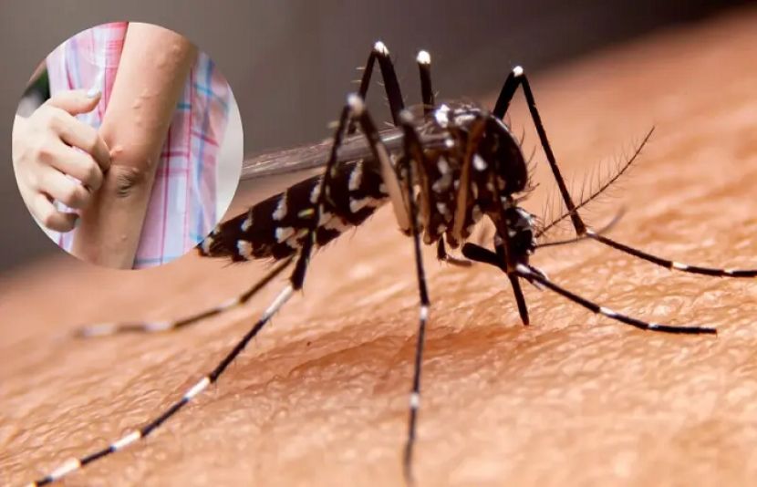 بعض افراد بار بار مچھروں کا نشانہ بنتے ہیں جبکہ دیگر نسبتاً محفوظ رہتے ہیں
