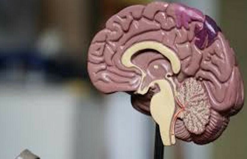 تحقیق کے مطابق نئی نسل میں ڈیمنشیا کا خطرہ پہلے کی نسبت کم ہو گیا ہے