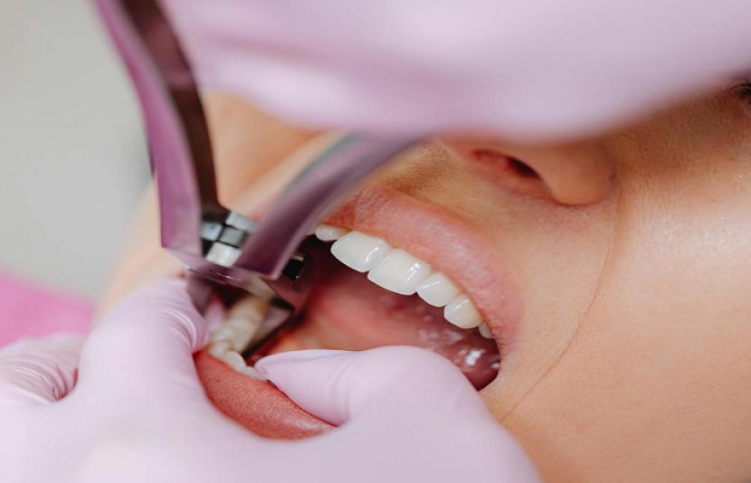 اکثر لوگوں کے ذہن میں یہ خدشہ ہوتا ہے کہ اگر دانت نکلوا لیا جائے تو آنکھوں کی بینائی متاثر ہو سکتی ہے