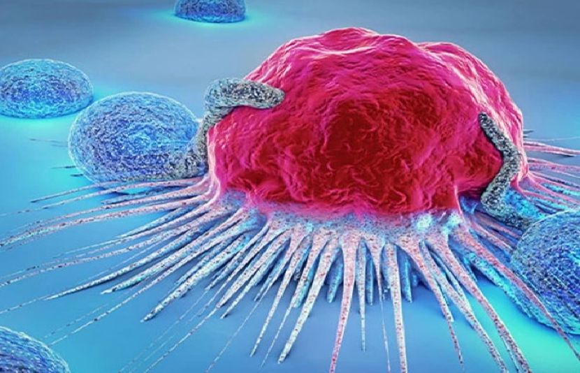 مٹاپا 50 برس سے کم عمر افراد میں بڑھتے ہوئے کینسر کیسز کی ایک بڑی وجہ بن سکتا ہے