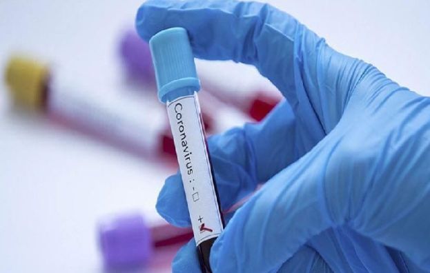 ملک بھرمیں 24 گھنٹوں کے دوران کورونا وائرس کے 70 کیس رپورٹ 