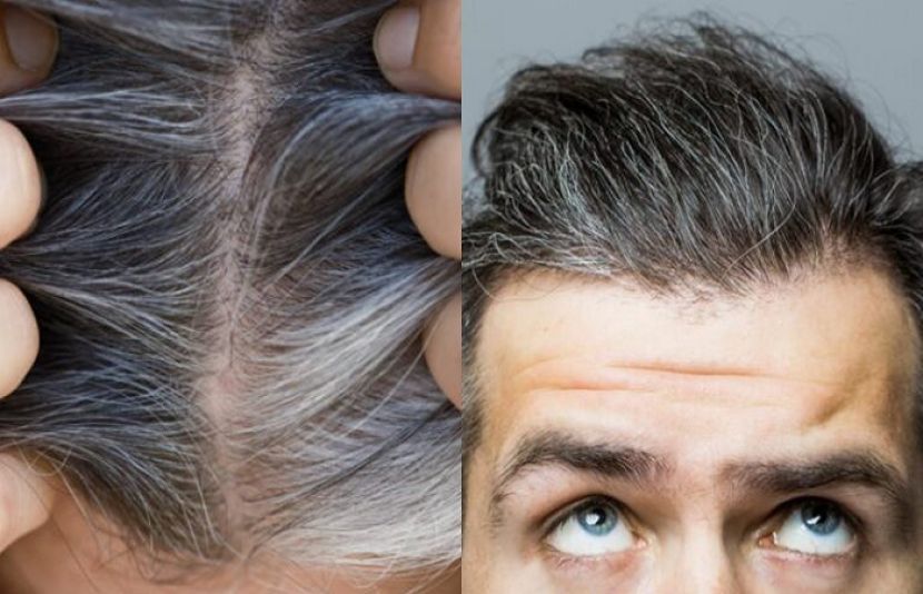 جوانی میں بال سفید ہونے کی وجہ کیا ہے؟