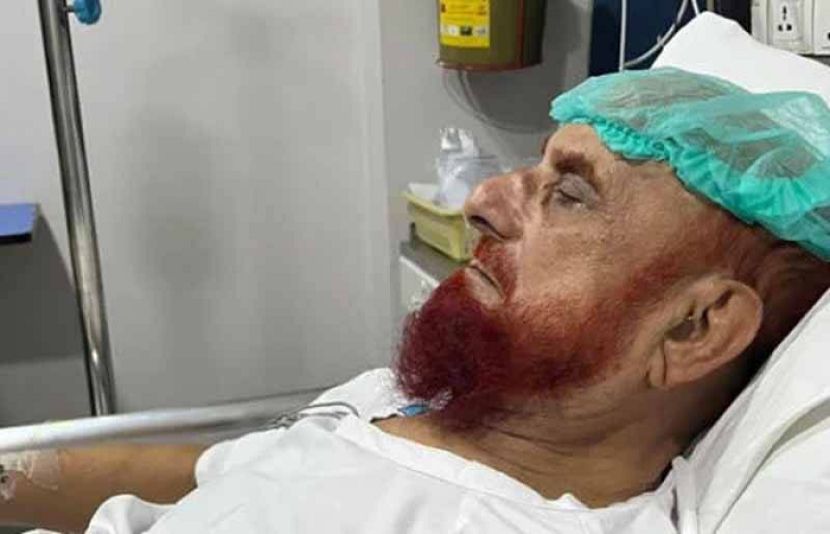 مفتی منیب الرحمان ڈینگی میں مبتلا، ہسپتال منتقل