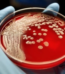 انسانی خون کے پیاسے بیکٹیریا کا انوکھا تجربہ
