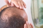 گنج پن میں مبتلا افراد کیلئے بڑی خوشخبری، علاج دریافت